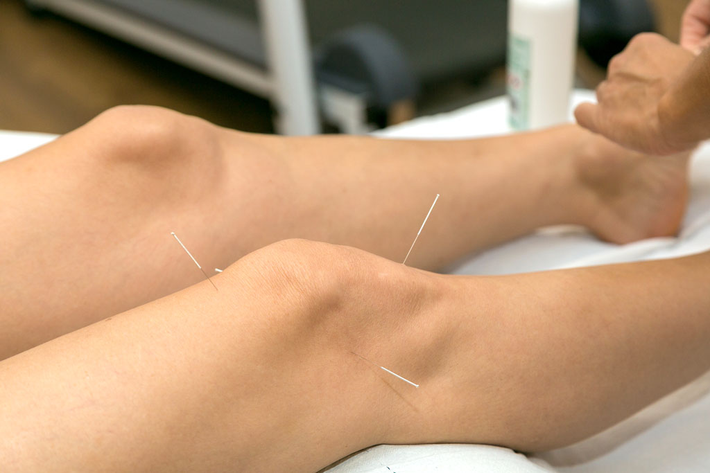 acupuncture treatment joint inflammation